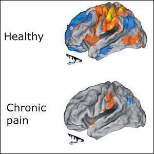 brain_pain